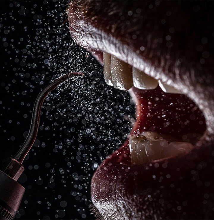 Пятиэтапная профессиональная гигиена полости рта