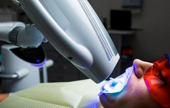 Профессиональное отбеливание зубов