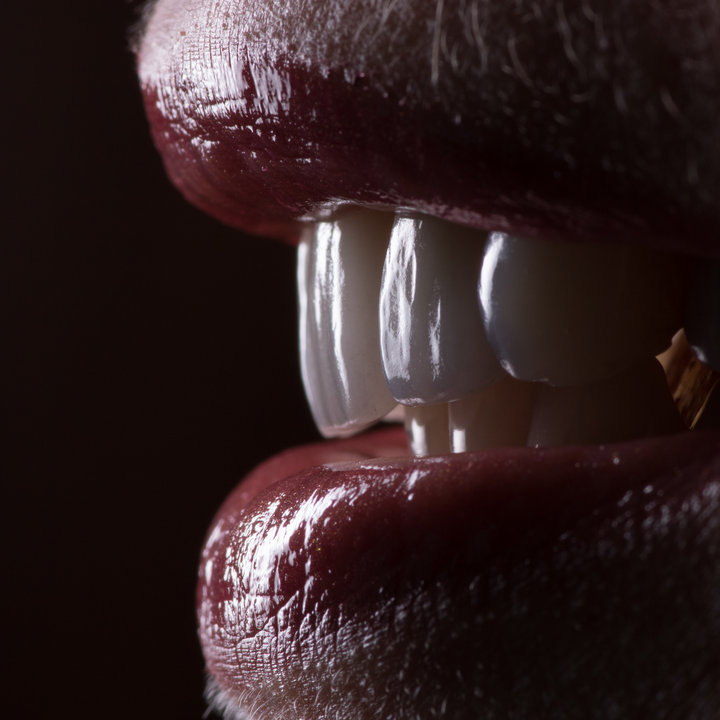 Виниры и люминиры