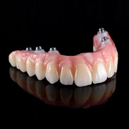 Комплексное протезирование зубов