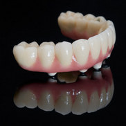 Восстановление зубов на имплантах