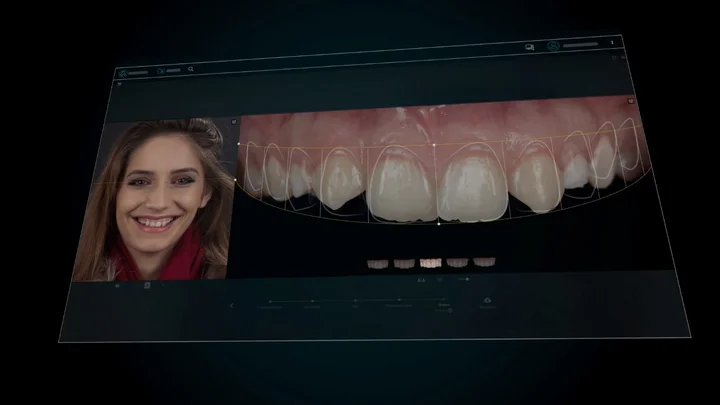 3D-моделирование зубов