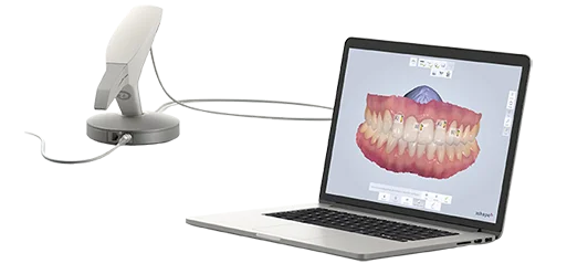 Снимаем цифровые 3D-слепки зубов