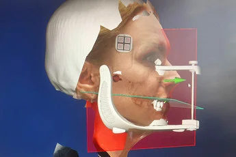 3D измерения челюсти