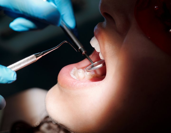 Подготовка полости рта к ортодонтическому лечению