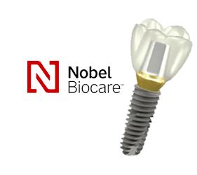 Имплант Nobel Biocare + коронка из диоксида циркония