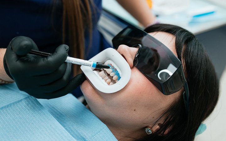 Отбеливание зубов