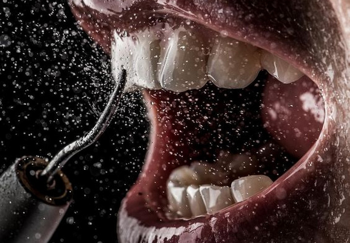 Профессиональная гигиена