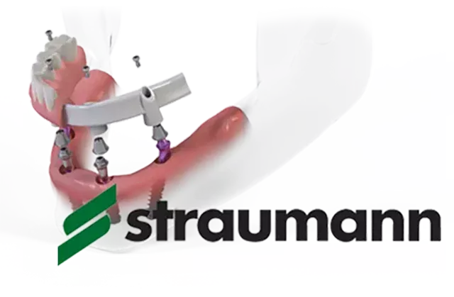 Зубные импланты Straumann